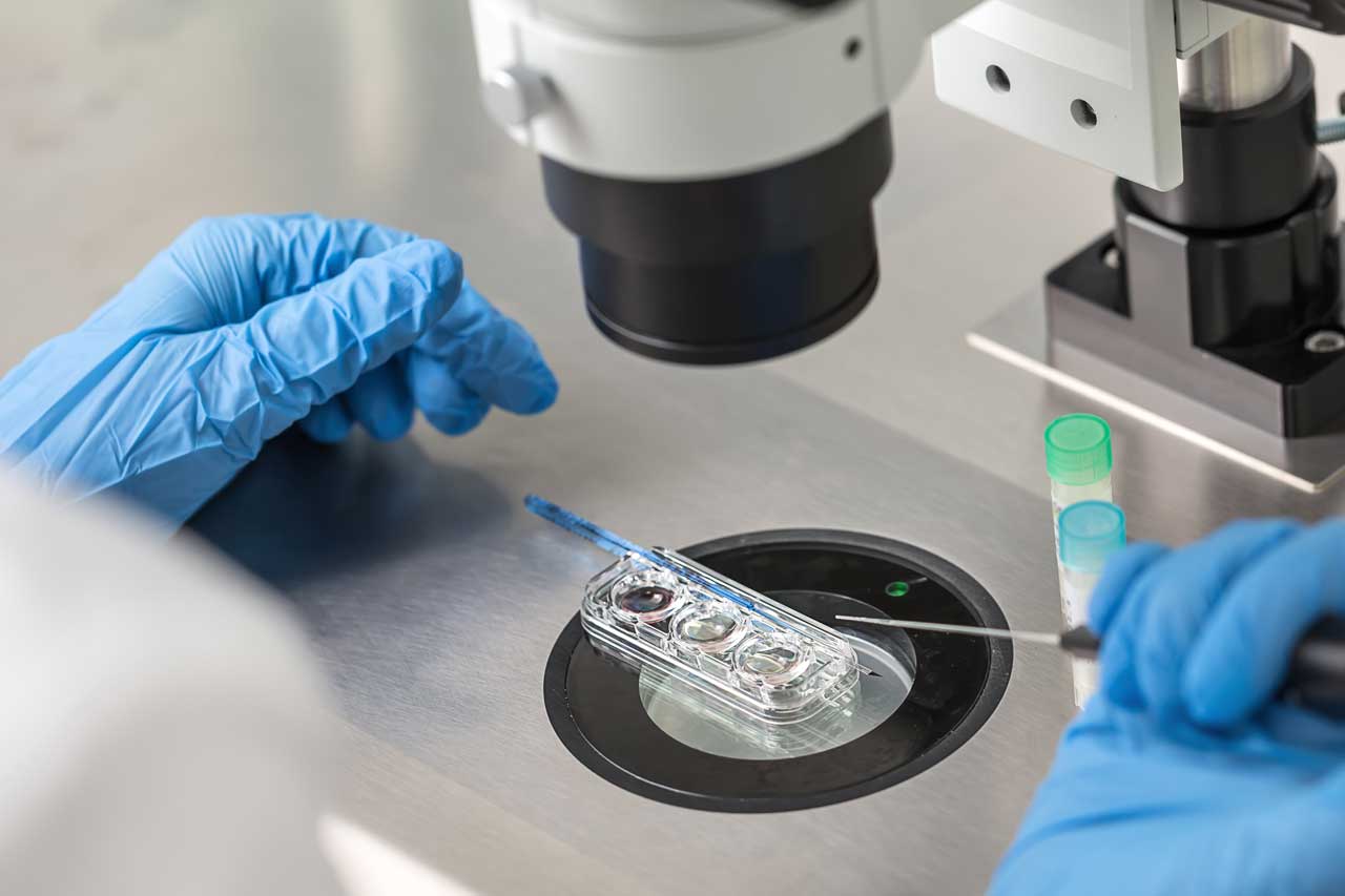 Alkioiden diagnostiikka ja seulonta Suomessa